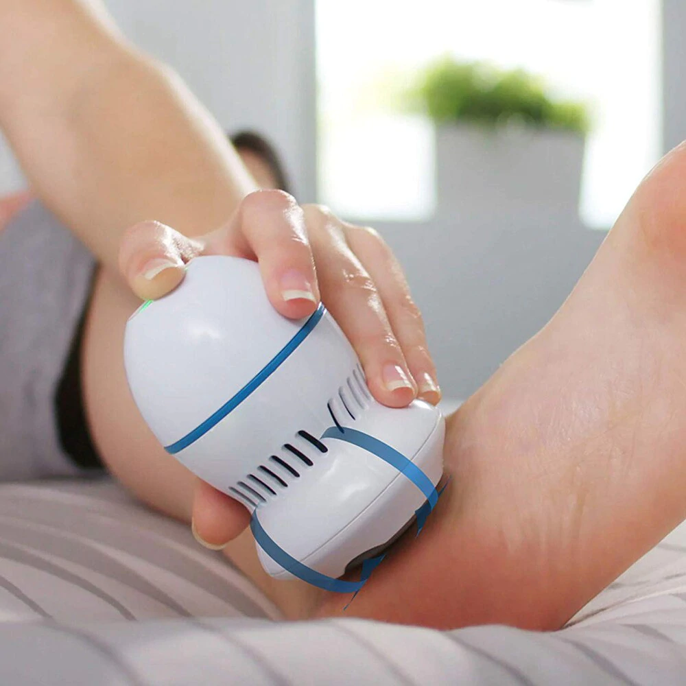 LOVELY™ | SMART CALLUS REMOVER